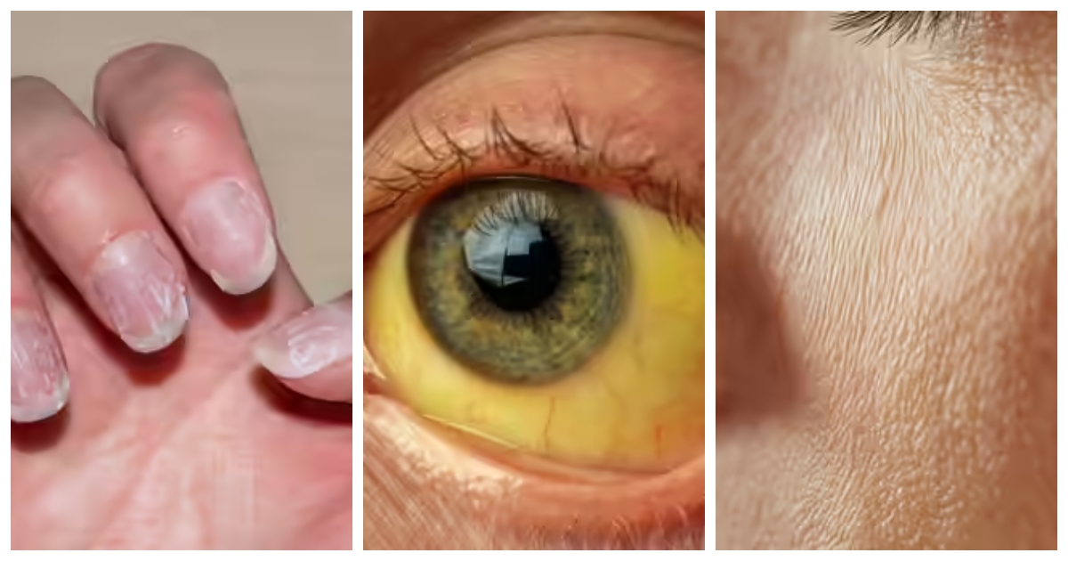 ত্বকের কিছু সাধারণ সমস্যাও জানান দেয় শরীরে ফুসফুস ক্যানসার বাসা বেঁধেছে। ছবি: টাইমস অব ইন্ডিয়া